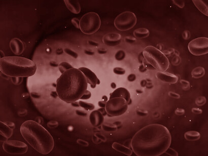 L’anemia è causata da numerose malattie acute e croniche