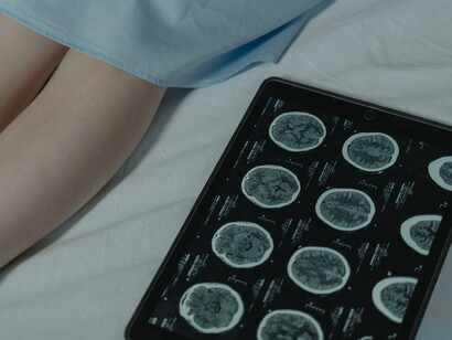 Resultado da tomografia computadorizada em tablet digital