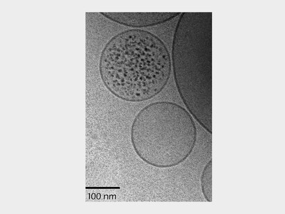 The “all-or-nothing” mechanism of the spontaneous overcrowding of biopolymers (the protein ferritin in this case) when vesicles are produced and close in situ (in the solution containing the biopolymers).