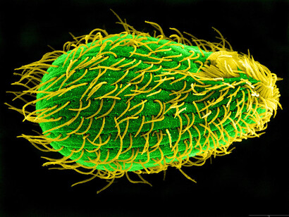 «Tetrahymena thermophila», utilizado en la biología experimental para identificar factores clave relacionados con la expresión de los genes y la integridad del genoma