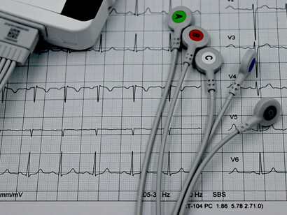 A close-up of an ECG printout displaying detailed heart monitor leads, commonly used in detecting and preventing heart disease