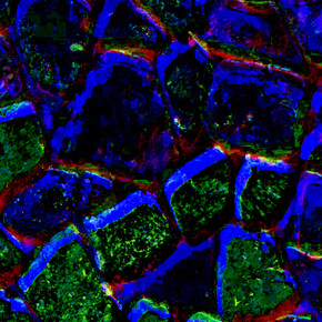 Wally Gilbert, Shadows (detail), 2024. Courtesy of Viridian Artists