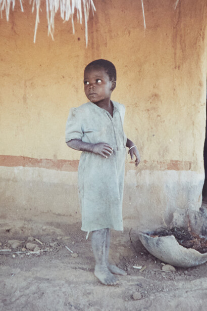 Child in Malawi, Africa. Photo by Cesar Chelala