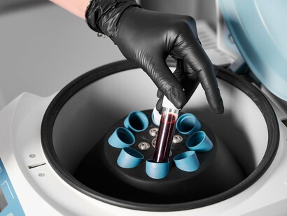 During PRP preparation, centrifugation concentrates growth factors that aid in skin regeneration