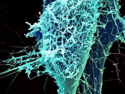 Virus dell'Ebola