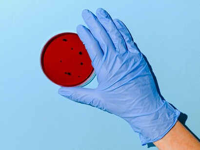 Cultura de bactérias.  Podem ser alvos de agentes patogénicos, mas também podem ajudar a proteger contra as infecções. Além disso, a A. muciniphilia é resistente a muitos antibióticos. Assim, o microbioma intestinal está parcialmente protegido dos antibióticos
