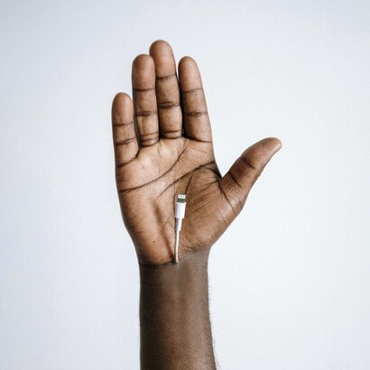 Mano con un cable USB integrado al cuerpo. Como artista cyborg, Esteban Celis tiene incorporado un dispositivo que le permite sentir el mundo de otra forma