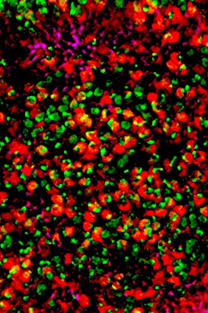 Imagen de las células de ala de la mosca de la fruta que muestra una proteína de fusión que es un impulsor clave de la leucemia megacarioblástica aguda 