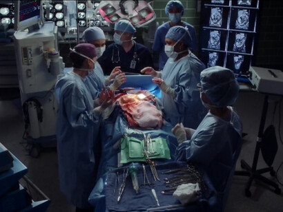 Anatomía de Grey. Operando a un paciente en el quirófano