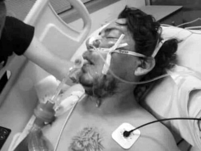 Las condiciones de Mario Acuña eran tan graves que fue necesario trasladarlo al Hospital Barros Luco, donde estuvo 4 meses en coma con serio riesgo vital