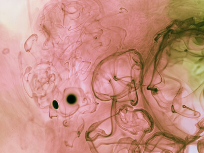 The placenta serves as a critical interface between mother and fetus, regulating nutrients, oxygen, and immune protection