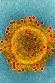 Imagen tomada con un microscopio electrónico de transmisión (TEM) y coloreada digitalmente que resalta la envoltura de partículas de un solo virión del coronavirus del síndrome respiratorio del Medio Oriente (MERS-CoV) 