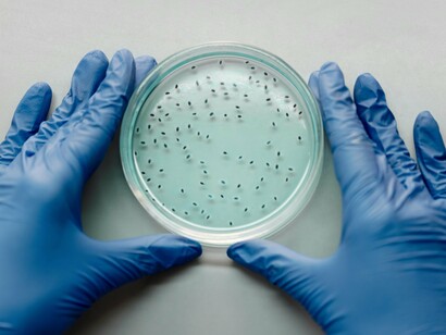 Petri dishes filled with thriving microbes, reflecting the complex world of the gut microbiome