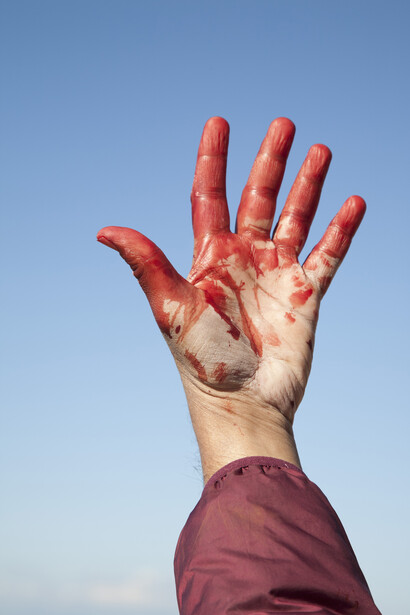 Imran Qureshi - La mano tinta di rosso di Imran Qureshi sfida il cielo dal tetto della torre Grossa
