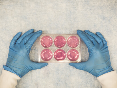 Two hands in plastics gloves holding a set of six medical samples