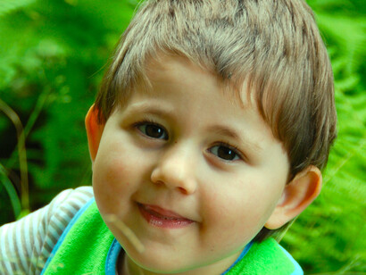 Niña con síndrome de Rett