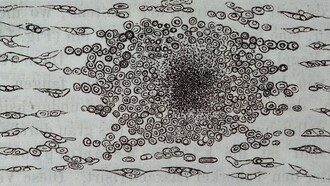 Figura 140 de la primera edición en alemán de la principal obra de Virchow:  «Die Cellularpathologie» («Patología celular»)