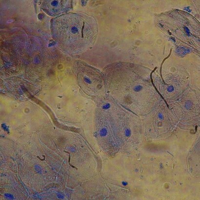 Cellule epiteliali, vista macroscopica 40X: "L'auto-rinnovamento è un altro aspetto chiave dell'autopoiesi. Le cellule del nostro corpo, ad esempio, si rinnovano costantemente attraverso processi di divisione e differenziazione"