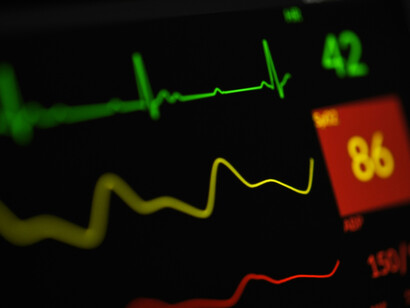 Traditional clinical models rely on a limited number of known risk factors, such as reduced heart function or prior heart attacks