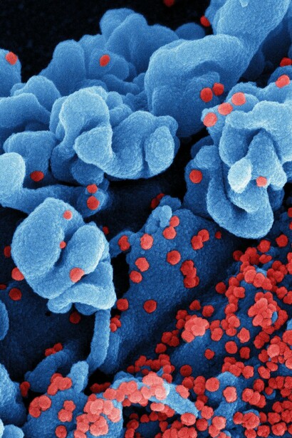 Célula infectada con partículas de la cepa omicrón virus SARS-CoV-2