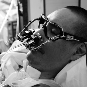 Zach Lieberman (American, b. 1977), James Powderly (American, b. 1976), Evan Roth (American, b. 1978), Chris Sugrue (American, b. 1978), TEMPT1 (American), and Theo Watson (British, b. 1981). EyeWriter. 2009. openFrameworks and custom software, eyeglasses, PlayStation Eye camera, IR pass filter, IR LEDs, battery clip, resistor, zip ties, and metal wire. 7 7/8 x 5 7/8 x 1 15/16″ (20 x 15 x 5 cm). Image by the EyeWriter Team. The Museum of Modern Art, New York. Architecture & Design Purchase Fund, 2011.