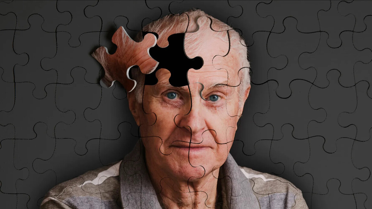 Representación gráfica de un hombre mayor con Alzheimer