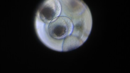 Un equipo científico británico-estadounidense ha logrado cultivar óvulos fuera del cuerpo humano hasta su última fase de desarrollo