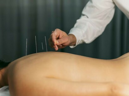 The acupuncture process, a foundational practice in traditional healing methods, within the realm of alternative medicine