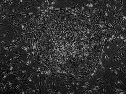 A closer look at nature’s repair toolkit—stem cells being explored for their regenerative potential in orthopedics