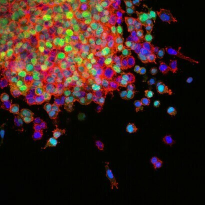 Das Immunsystem durchsucht den Körper, findet Krebszellen und zielt darauf ab, sie zu zerstören: das nennt man Immunüberwachung