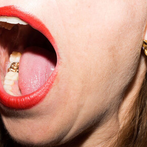 Reflections. Courtesy of Kunsthistorisches Museum Wien