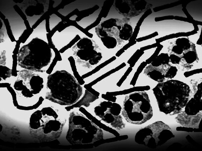 Maladie du charbon. Il y a bien deux types de bacilles, l’un virulent l’autre non virulent mais tous deux bien vivants