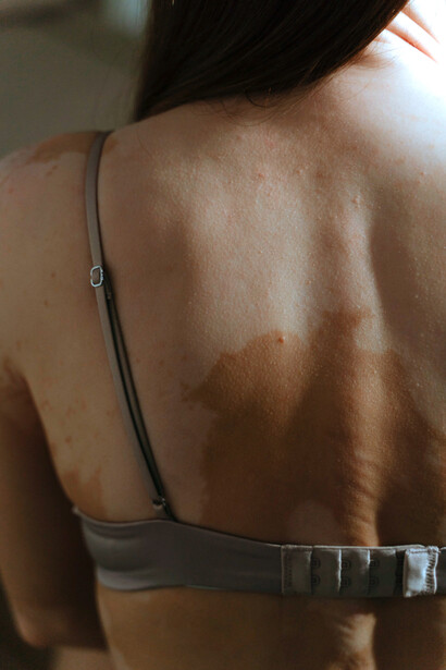 Acercamiento a la espalda de una mujer