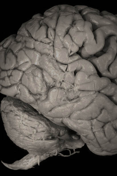 El cerebro humano se encarga tanto de regular y mantener cada función vital del cuerpo, como de ser el órgano donde reside la mente y la conciencia del individuo