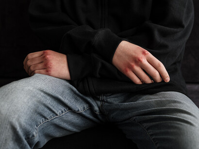 Dos onze ataques, seus executores tem identificação com o ódio e suas múltiplas formas simbólicas e práticas