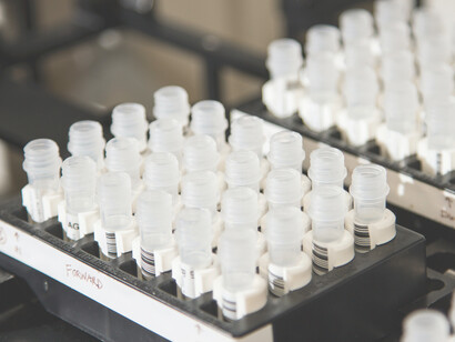 Fläschchen mit DNA-Proben