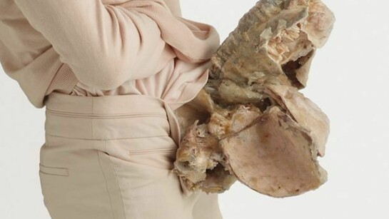 Aetiology Unknown 17, 2012 / 110 x 80 cm (43 5/16 x 31 ½ in. Ultrachrome print, photo janmanski.com