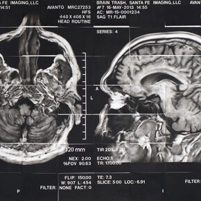 James Drake, The Anatomy of Drawing and Space (Brain Trash) –  from Chapter 6 (detail), 2012-2013, mixed media on paper. Courtesy of the artist. ©James Drake 2013.