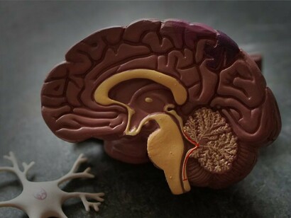 L'IBS, o sindrome dell'intestino irritabile, è quindi un disturbo gastrointestinale multifattoriale che coinvolge il tratto gastrointestinale, in particolare il colon