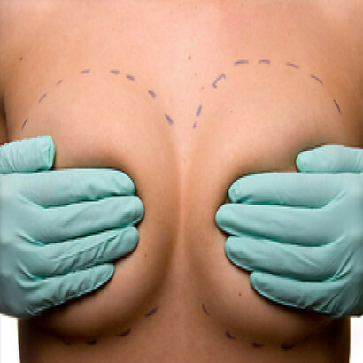 Violencia estética. Preparativos para una operación de aumento de pecho