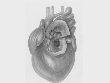 Nuovi farmaci, tra cui quelli per il controllo del peso e del colesterolo, stanno modificando l’approccio terapeutico in cardiologia