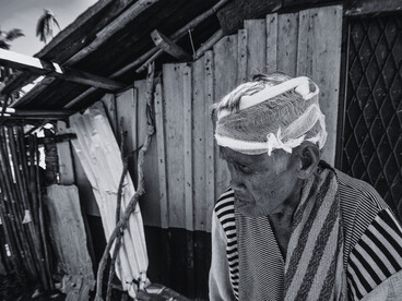 An injured resident outside a storm-battered home, representing the vulnerability of communities living through repeated disasters