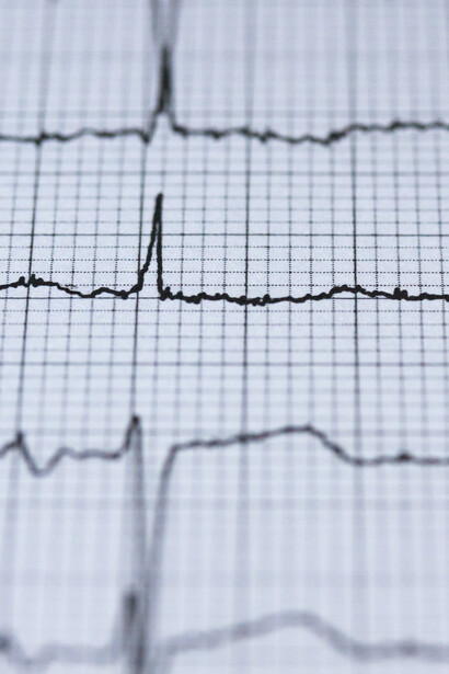 Cuore, esame cardiologico. Non è solo l’inquinamento atmosferico a nuocere al cuore, il rumore del traffico, ad esempio, può portare a un aumento della frequenza cardiaca 