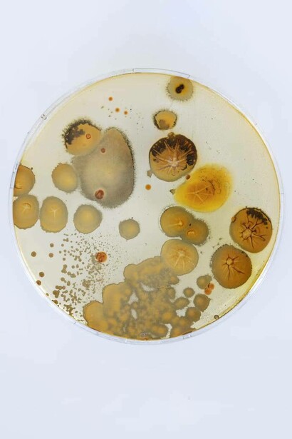 Kelvin Haizel, Unseen allies. A set of ten petri dishes with cultured microbes, 1885-2026. Courtesy of FOMU Foto Museum