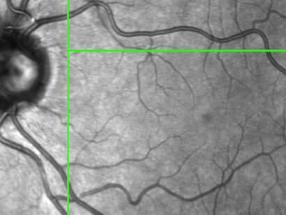 Dryden Goodwin, Still of eye © Dryden Goodwin