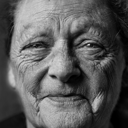 Metformin’s target signaling pathways associated with anti-aging benefits have been extensively investigated over the past years