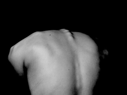 Los pacientes de cáncer cargan con la cruz de la quimioterapia