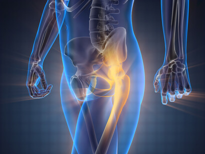 L'osteoporosi comporta una fragilità e sensibilità alle fratture
