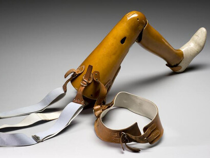 Wounded. Courtesy of Science Museum