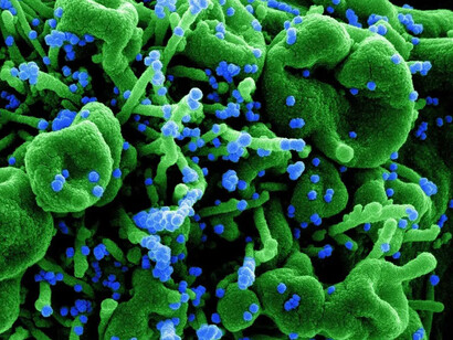 Se han reportado secuelas serias después de pasada la infección, eso es un motivo más para vacunarse